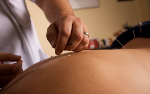 Acupuncture Clinic of Tom Ingegno