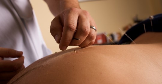 Acupuncture Clinic of Tom Ingegno