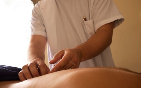 Acupuncture